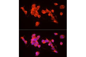 Immunofluorescence analysis of SH-SY5Y cells using GDNF Rabbit pAb (ABIN7267388) at dilution of 1:100 (40x lens). (GDNF antibody  (AA 109-211))