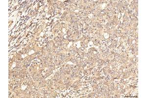 IHC analysis of BHMT using anti-BHMT antibody (ABIN7599940). (BHMT antibody  (AA 13-386))