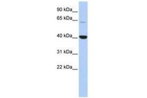 Image no. 1 for anti-Methyl-CpG Binding Domain Protein 1 (MBD1) (C-Term) antibody (ABIN6742952) (MBD1 antibody  (C-Term))