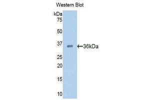 Western Blotting (WB) image for anti-Proprotein Convertase Subtilisin/kexin Type 9 (PCSK9) (AA 156-461) antibody (ABIN1860147) (PCSK9 antibody  (AA 156-461))