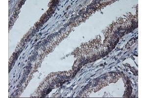 Image no. 3 for anti-Archain 1 (ARCN1) antibody (ABIN1497571) (ARCN1 antibody)