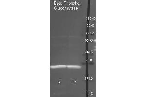 Goat anti antibody  was used to detect purified Beta Phospho Glucomutase under reducing (R) and non-reducing (NR) conditions. (Beta-Phosphoglucomutase antibody)