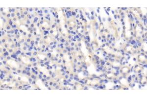 Detection of IGF1 in Mouse Kidney Tissue using Polyclonal Antibody to Insulin Like Growth Factor 1 (IGF1) (IGF1 antibody  (AA 33-102))