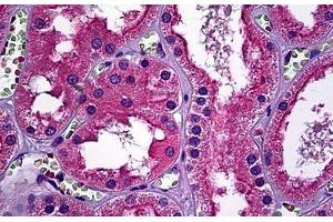 Immunohistochemistry (Formalin-fixed Paraffin-embedded Sections) (IHC (fp)) image for anti-Receptor Tyrosine-Protein Kinase ErbB-3 (ERBB3) (AA 21-332) antibody (ABIN790480)