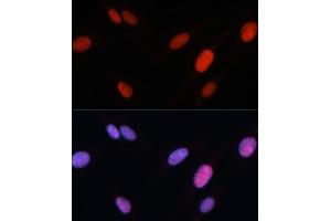 Immunofluorescence analysis of U-2 OS cells using FOSL2 antibody (ABIN3016548, ABIN3016549, ABIN3016550 and ABIN6219779) at dilution of 1:100. (FOSL2 antibody  (AA 187-326))
