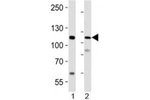 Western blot analysis of lysate from 1) human LNCaP cell line and 2) mouse lung tissue using PRDM16 antibody at 1:1000. (PRDM16 antibody)