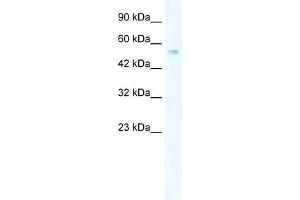 WB Suggested Anti-ZNF613 Antibody Titration:  0. (ZNF613 antibody  (C-Term))