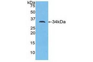 Detection of Recombinant MYO1D, Mouse using Polyclonal Antibody to Myosin ID (MYO1D)