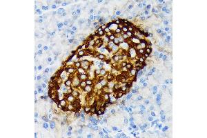 Immunohistochemistry of paraffin-embedded rat pancreatic islet using Chromogranin A Rabbit mAb (ABIN7266366) at dilution of 1:100 (40x lens). (Chromogranin A antibody)