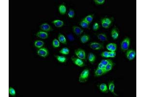 Immunofluorescent analysis of A549 cells using ABIN7171373 at dilution of 1:100 and Alexa Fluor 488-congugated AffiniPure Goat Anti-Rabbit IgG(H+L) (CD1c antibody  (AA 18-302))