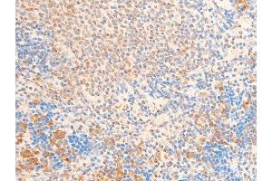 Immunohistochemistry (IHC) image for anti-Forkhead Box O3 (FOXO3) (pSer253) antibody (ABIN6255131)