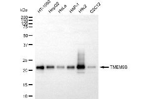 Western blotting analysis using TMEM9B antibody (ABIN7800560). (Recombinant TMEM9B antibody)