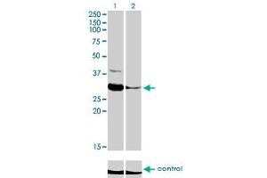 Western blot analysis of ZNF215 over-expressed 293 cell line, cotransfected with ZNF215 Validated Chimera RNAi (Lane 2) or non-transfected control (Lane 1). (ZNF215 antibody  (AA 1-304))