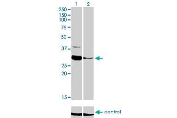 ZNF215 anticorps  (AA 1-304)