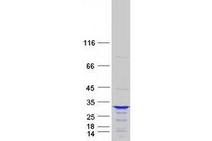 Western Blotting (WB) image for Coiled-Coil Domain Containing 28B (CCDC28B) protein (Myc-DYKDDDDK Tag) (ABIN2713296)