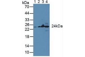 Figure. (GSTK1 antibody  (AA 19-222))