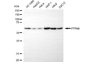 Western blotting analysis using PTPN9 antibody (ABIN7800043).
