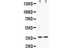 Western blot analysis of HDGF expression in rat liver extract ( Lane 1) and 22RV1 whole cell lysates ( Lane 2).