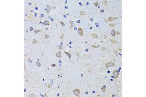 Immunohistochemistry of paraffin-embedded mouse brain using PTPN1 antibody.