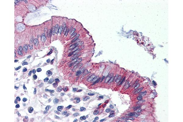 TJP3 antibody  (C-Term)
