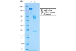 SDS-PAGE analysis of purified, BSA-free recombinant MART-1 antibody (clone MLANA/1409R) as confirmation of integrity and purity. (Recombinant MLANA antibody)