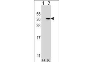 Western blot analysis of SPDYA (arrow) using rabbit polyclonal SPDYA Antibody (Center) (ABIN6244012 and ABIN6579062). (SPDYA antibody  (AA 147-175))