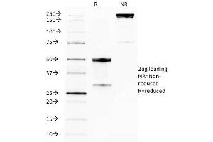 SDS-PAGE Analysis Purified GITR Mouse Monoclonal Antibody (DTA-1).