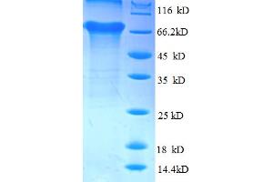 SDS-PAGE (SDS) image for TAR DNA Binding Protein (TARDBP) (AA 1-396), (partial) protein (GST tag) (ABIN5710454)
