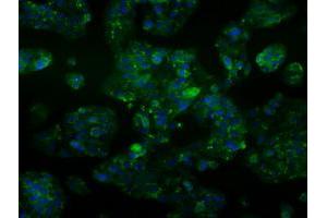 Image no. 3 for anti-Aldehyde Dehydrogenase 2 Family (Mitochondrial) (ALDH2) antibody (ABIN1496589) (ALDH2 antibody)