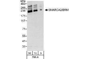 Western Blotting (WB) image for anti-SWI/SNF Related, Matrix Associated, Actin Dependent Regulator of Chromatin, Subfamily A, Member 2 (SMARCA2) (AA 1-50) antibody (ABIN7452044)