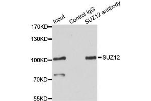 Immunoprecipitation analysis of 200ug extracts of HeLa cells using 3ug SUZ12 antibody.