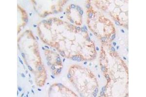 IHC-P analysis of Human Tissue, with DAB staining. (Cyclin D1 antibody  (AA 1-295))