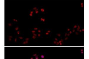 Immunofluorescence analysis of HeLa cells using PCNA Polyclonal Antibody at dilution of 1:100. (PCNA antibody)