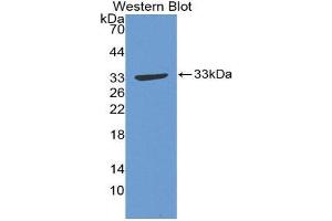 Western Blotting (WB) image for anti-Growth Associated Protein 43 (GAP43) (AA 1-274) antibody (ABIN1868109) (GAP43 antibody  (AA 1-274))