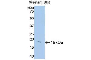 Western Blotting (WB) image for anti-Uncoupling Protein 2 (Mitochondrial, Proton Carrier) (UCP2) (AA 150-304) antibody (ABIN3205057) (UCP2 antibody  (AA 150-304))