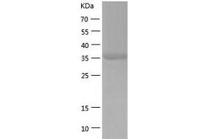 CCDC104 Protein (AA 1-342) (His tag)