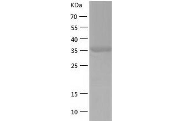 CCDC104 Protein (AA 1-342) (His tag)