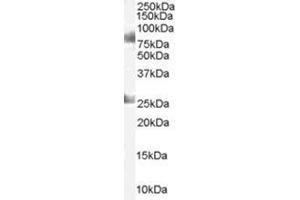 Image no. 1 for anti-Chromodomain Protein, Y-Like (CDYL) (C-Term) antibody (ABIN374294) (CDYL antibody  (C-Term))