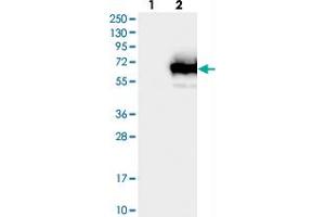 Western blot analysis of Lane 1: Negative control (vector only transfected HEK293T lysate), Lane 2: Over-expression Lysate (Co-expressed with a C-terminal myc-DDK tag (~3. (TCP11L1 antibody)