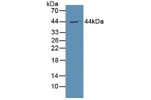 Detection of EP3 in Mouse Kidney Tissue using Polyclonal Antibody to Prostaglandin E Receptor 3 (EP3) (PTGER3 antibody  (AA 217-390))