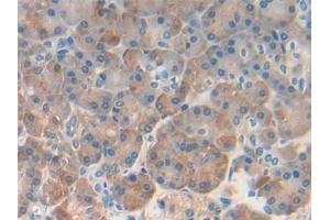 Immunohistochemistry (IHC) image for anti-Regenerating Islet-Derived 1 beta (REG1B) (AA 23-166) antibody (ABIN7435832)