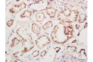 Formalin-fixed and paraffin embedded human kindey labeled with Rabbit Anti-Calmodulin/CaM I Polyclonal Antibody, Unconjugated 1:200 followed by conjugation to the secondary antibody and DAB staining (Calmodulin 1 antibody  (AA 81-152))