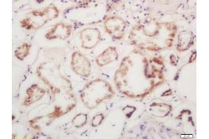 Formalin-fixed and paraffin embedded human kindey labeled with Rabbit Anti-Calmodulin/CaM I Polyclonal Antibody, Unconjugated 1:200 followed by conjugation to the secondary antibody and DAB staining (Calmodulin 1 antibody  (AA 81-152))