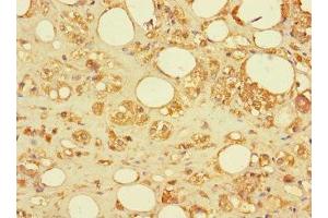 Immunohistochemistry of paraffin-embedded human adrenal gland tissue using ABIN7170737 at dilution of 1:100 (SAMD12 antibody  (AA 1-201))