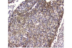 IHC analysis of NMI using anti-NMI antibody (ABIN3043451). (NMI antibody  (AA 2-307))