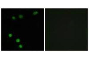 Immunofluorescence analysis of MCF-7 cells, using TP53INP2 antibody. (TP53INP2 antibody)