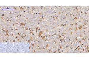 Immunohistochemistry of paraffin-embedded Mouse brain tissue with Phospho-FAK (Tyr397) Polyclonal Antibody at dilution of 1:200 (FAK antibody  (pTyr397))