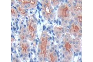 IHC-P analysis of Mouse Tissue, with DAB staining. (PCSK9 antibody  (AA 156-694))