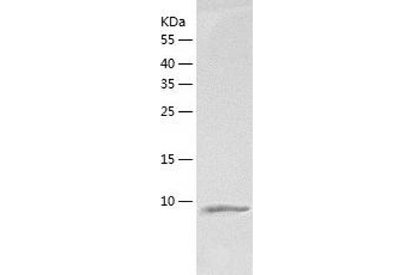 DYNLT1 Protein (AA 1-113) (His tag)