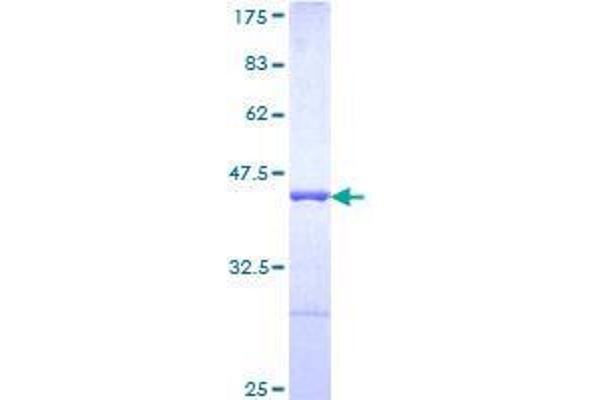 AHNAK Protein (AA 1-100) (GST tag)